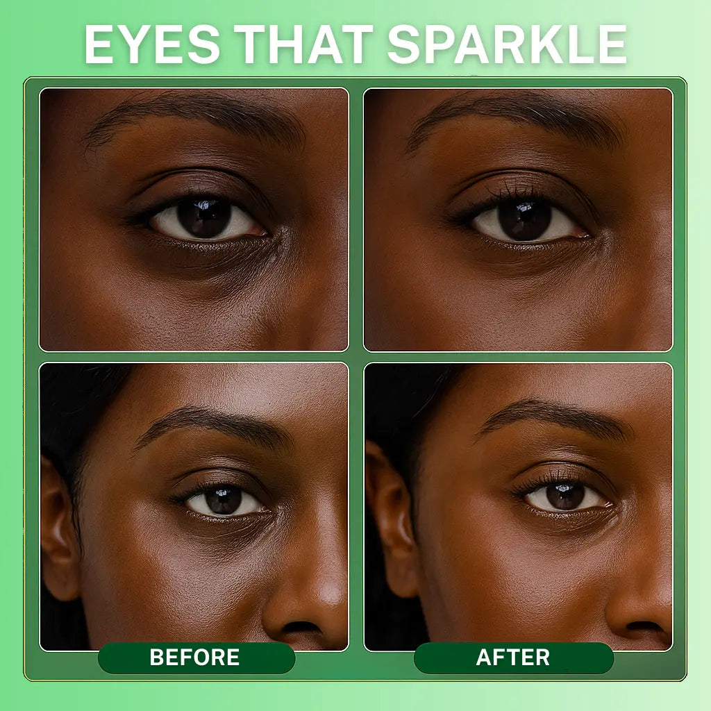 AvocaGlow Eye Revival Masks