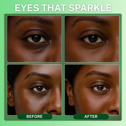 AvocaGlow Eye Revival Masks